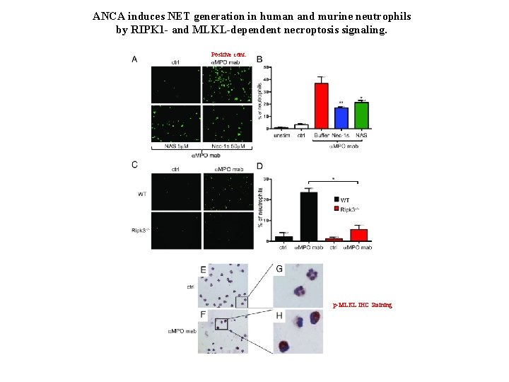 ANCA induces NET generation in human and murine neutrophils by RIPK 1 - and