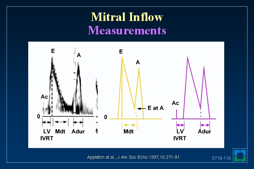 Mitral Inflow Measurements Appleton et al. , J Am Soc Echo 1997; 10: 271