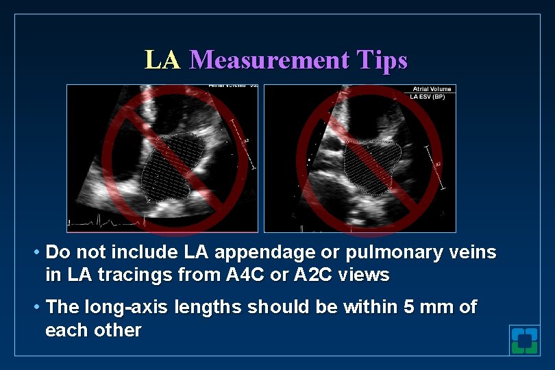 LA Measurement Tips • Do not include LA appendage or pulmonary veins in LA