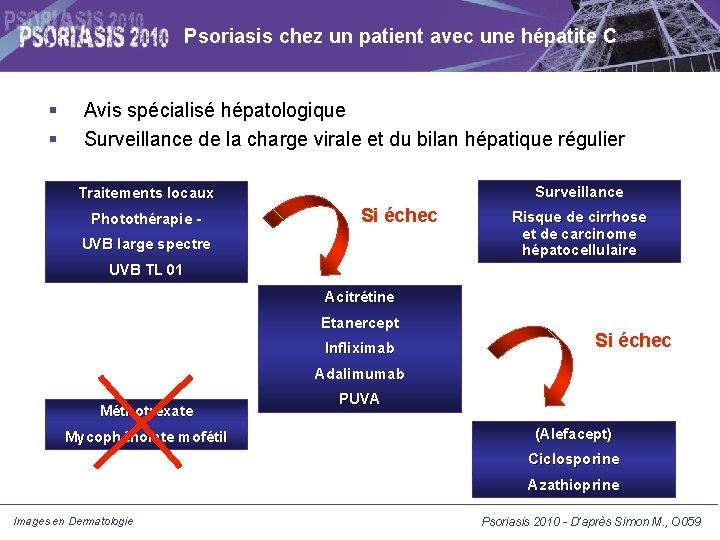 Psoriasis chez un patient avec une hépatite C Avis spécialisé hépatologique Surveillance de la Psoriasis chez un patient avec une hépatite C Avis spécialisé hépatologique Surveillance de la