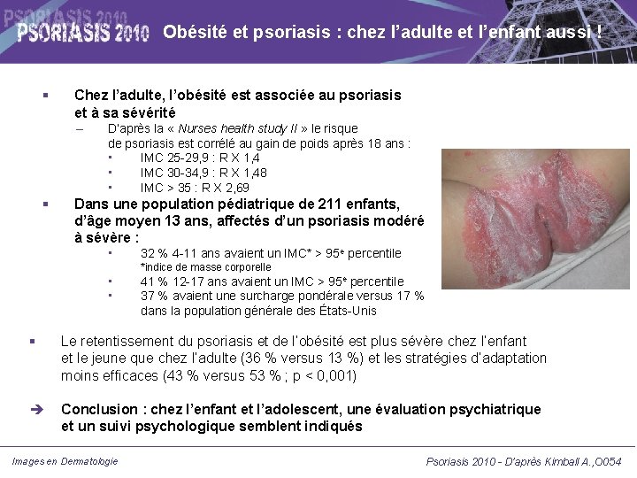 Obésité et psoriasis : chez l’adulte et l’enfant aussi ! Chez l’adulte, l’obésité est Obésité et psoriasis : chez l’adulte et l’enfant aussi ! Chez l’adulte, l’obésité est