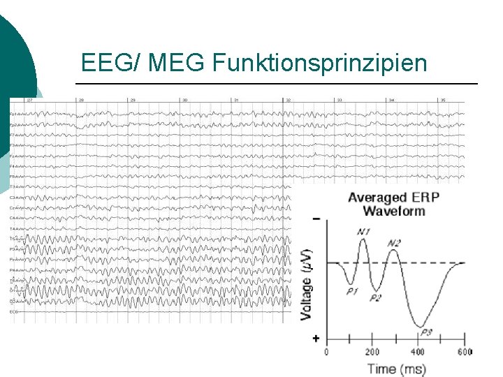 EEG/ MEG Funktionsprinzipien 