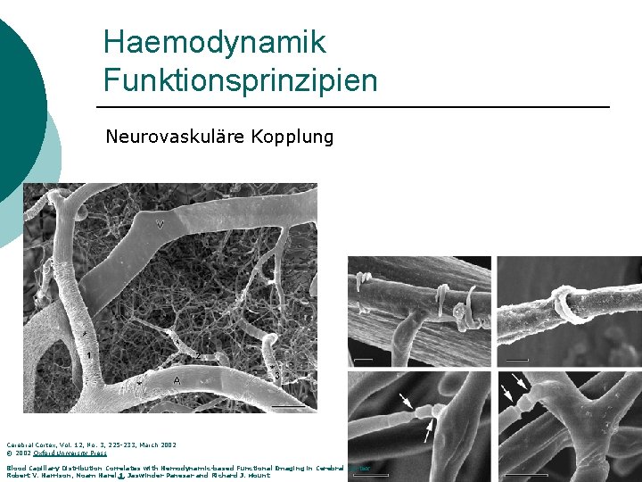 Haemodynamik Funktionsprinzipien Neurovaskuläre Kopplung Cerebral Cortex, Vol. 12, No. 3, 225 -233, March 2002