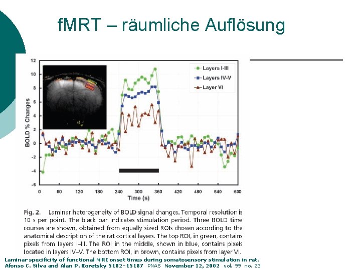 f. MRT – räumliche Auflösung Laminar specificity of functional MRI onset times during somatosensory