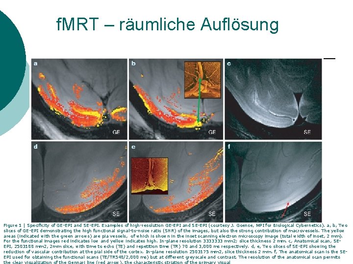 f. MRT – räumliche Auflösung Figure 1 | Specificity of GE-EPI and SE-EPI. Examples