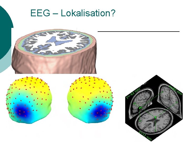 EEG – Lokalisation? 