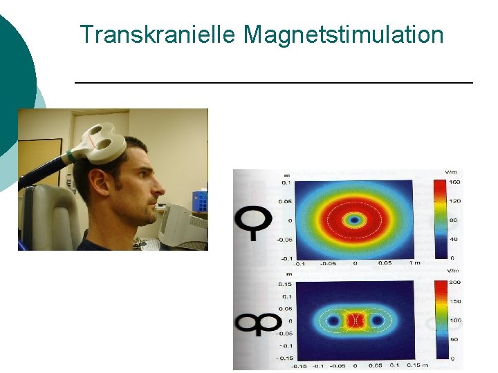 Transkranielle Magnetstimulation 