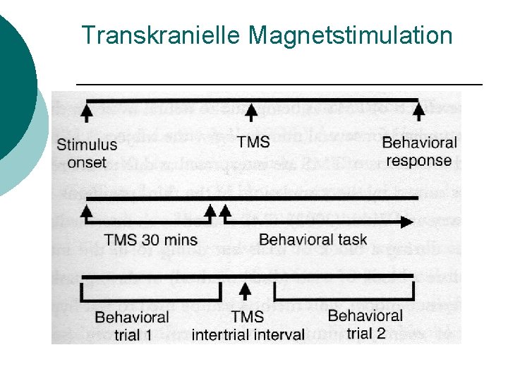 Transkranielle Magnetstimulation 