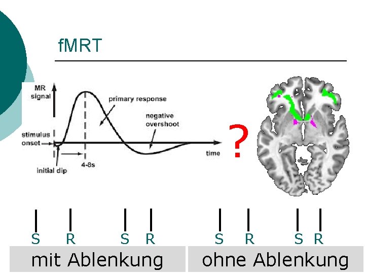 f. MRT ? S R mit Ablenkung S R ohne Ablenkung 