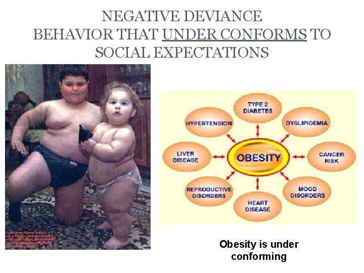 NEGATIVE DEVIANCE BEHAVIOR THAT UNDER CONFORMS TO SOCIAL EXPECTATIONS Obesity is under conforming 