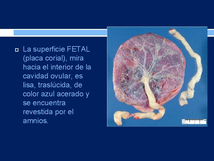  La superficie FETAL (placa corial), mira hacia el interior de la cavidad ovular,