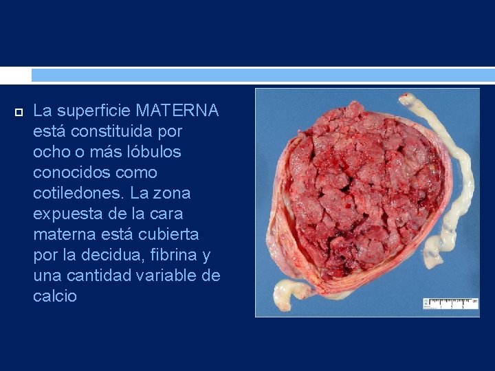  La superficie MATERNA está constituida por ocho o más lóbulos conocidos como cotiledones.