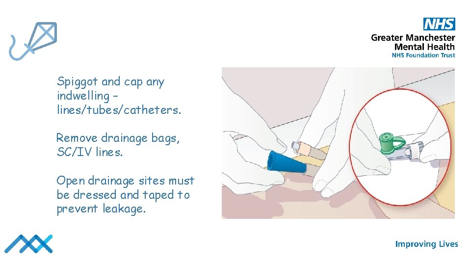 Spiggot and cap any indwelling – lines/tubes/catheters. Remove drainage bags, SC/IV lines. Open drainage