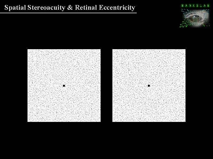 Spatial Stereoacuity & Retinal Eccentricity Spatial Stereoacuity & Retinal Eccentricity