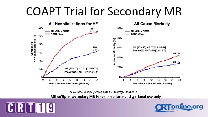 COAPT Trial for Secondary MR Stone GW et al. N Engl J Med. 2018