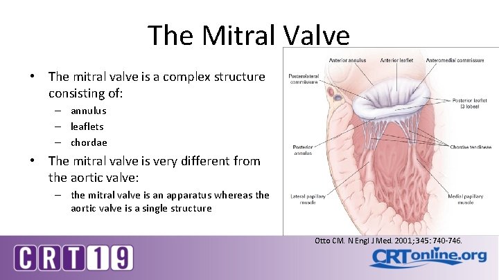 The Mitral Valve • The mitral valve is a complex structure consisting of: –