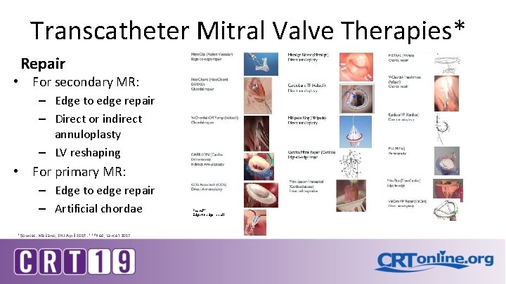 Transcatheter Mitral Valve Therapies* Repair • For secondary MR: – Edge to edge repair