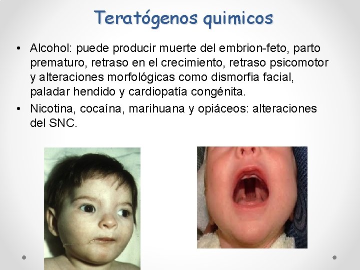 Teratógenos quimicos • Alcohol: puede producir muerte del embrion-feto, parto prematuro, retraso en el Teratógenos quimicos • Alcohol: puede producir muerte del embrion-feto, parto prematuro, retraso en el