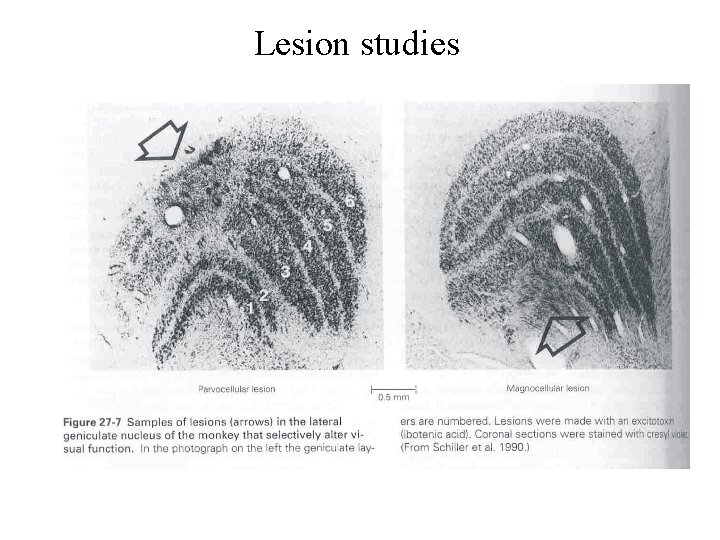 Lesion studies 