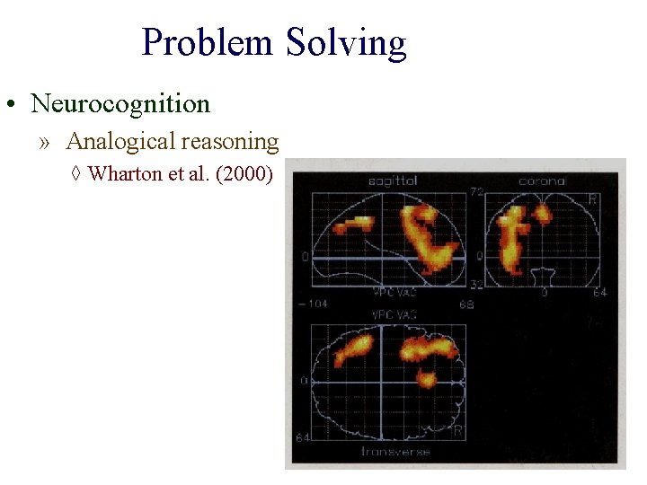 Problem Solving • Neurocognition » Analogical reasoning ◊ Wharton et al. (2000) 