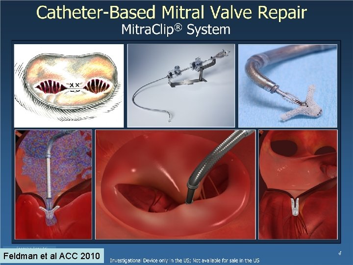 Feldman et al ACC 2010 