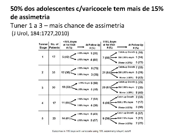 50% dos adolescentes c/varicocele tem mais de 15% de assimetria Tuner 1 a 3 50% dos adolescentes c/varicocele tem mais de 15% de assimetria Tuner 1 a 3