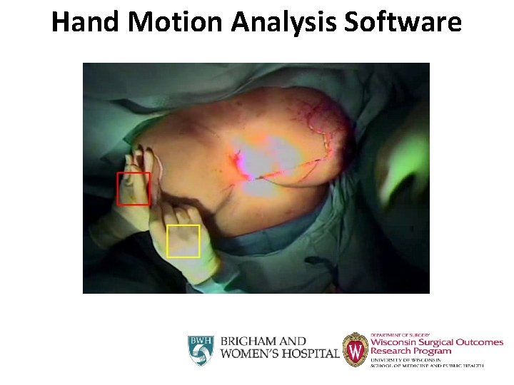 Hand Motion Analysis Software 