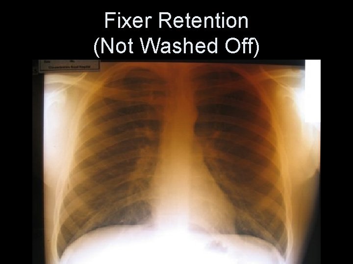 Fixer Retention (Not Washed Off) 