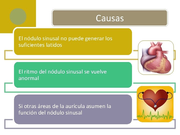 Causas El nódulo sinusal no puede generar los suficientes latidos El ritmo del nódulo