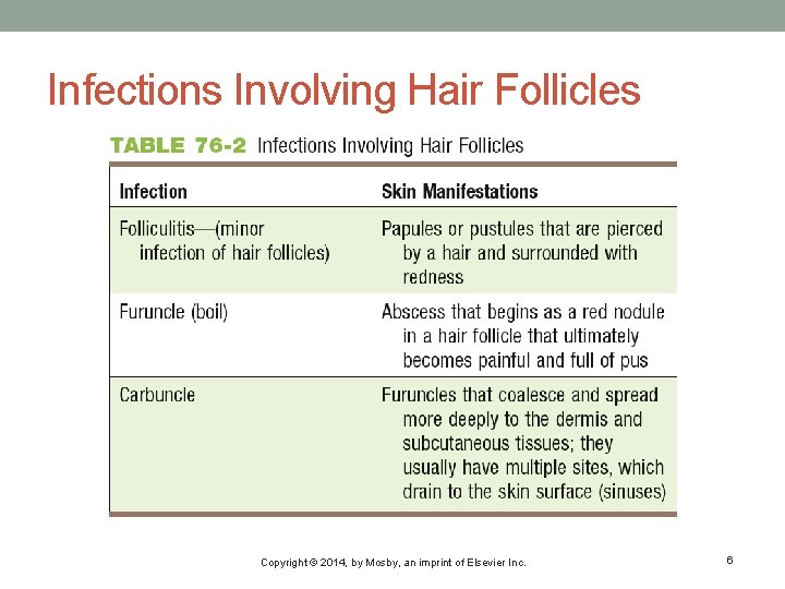 Infections Involving Hair Follicles Copyright © 2014, by Mosby, an imprint of Elsevier Inc.