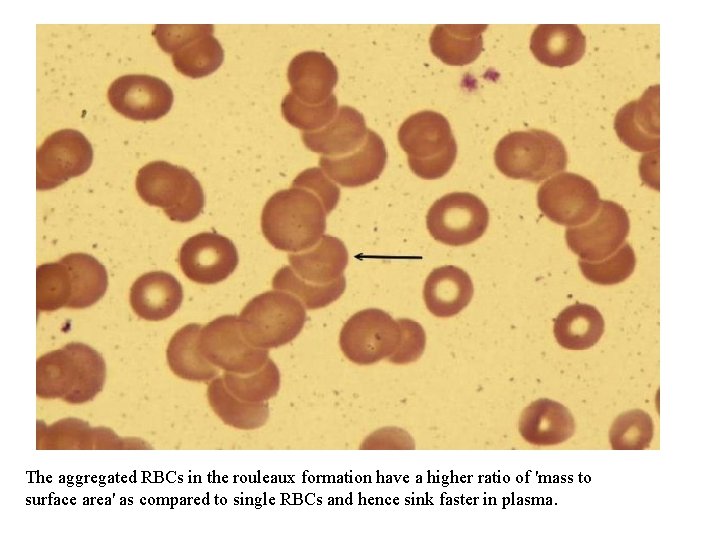 The aggregated RBCs in the rouleaux formation have a higher ratio of 'mass to