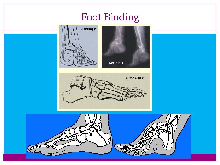 Foot Binding Foot Binding