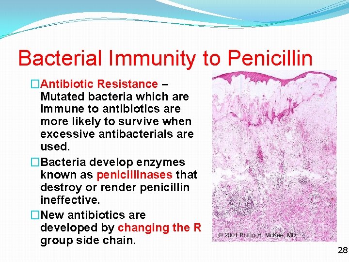 Bacterial Immunity to Penicillin �Antibiotic Resistance – Mutated bacteria which are immune to antibiotics