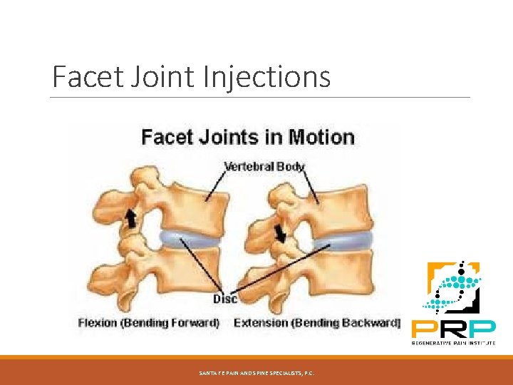 Facet Joint Injections SANTA FE PAIN AND SPINE SPECIALISTS, P. C. 