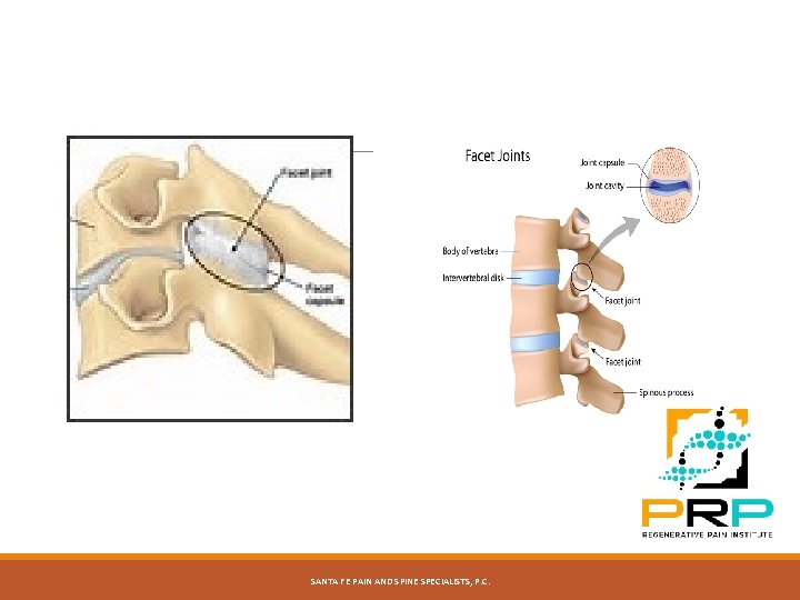 SANTA FE PAIN AND SPINE SPECIALISTS, P. C. 