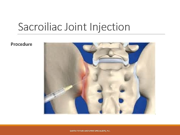 Sacroiliac Joint Injection Procedure SANTA FE PAIN AND SPINE SPECIALISTS, P. C. 