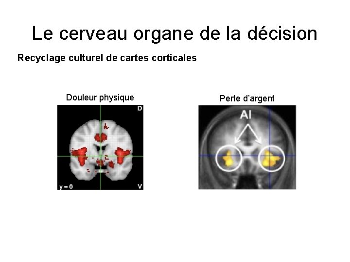 Le cerveau organe de la décision Recyclage culturel de cartes corticales Douleur physique Perte