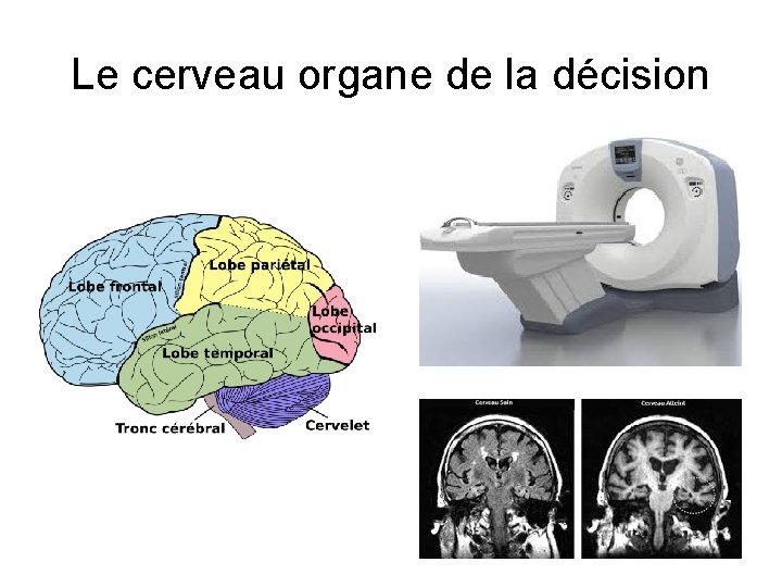 Le cerveau organe de la décision 