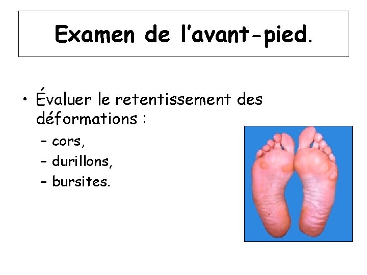 Examen de l’avant-pied. • Évaluer le retentissement des déformations : – cors, – durillons,