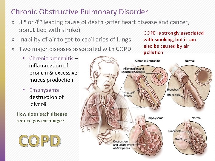 Chronic Obstructive Pulmonary Disorder » 3 rd or 4 th leading cause of death