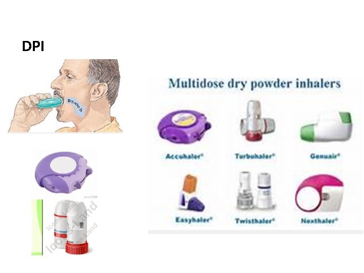 Bronchial Asthma in Children Enas Mohammad Al Zayadneh