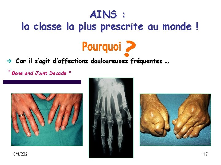 AINS : la classe la plus prescrite au monde ! Car il s’agit d’affections AINS : la classe la plus prescrite au monde ! Car il s’agit d’affections