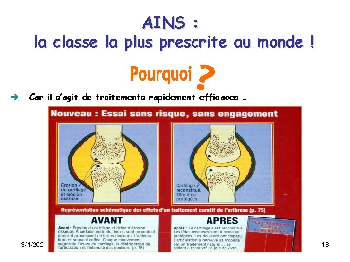 Les antiinflammatoires non strodiens AINS 342021 1 Les