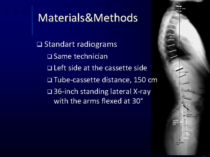 Materials&Methods q Standart radiograms q Same technician q Left side at the cassette side