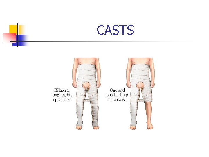 CASTS 