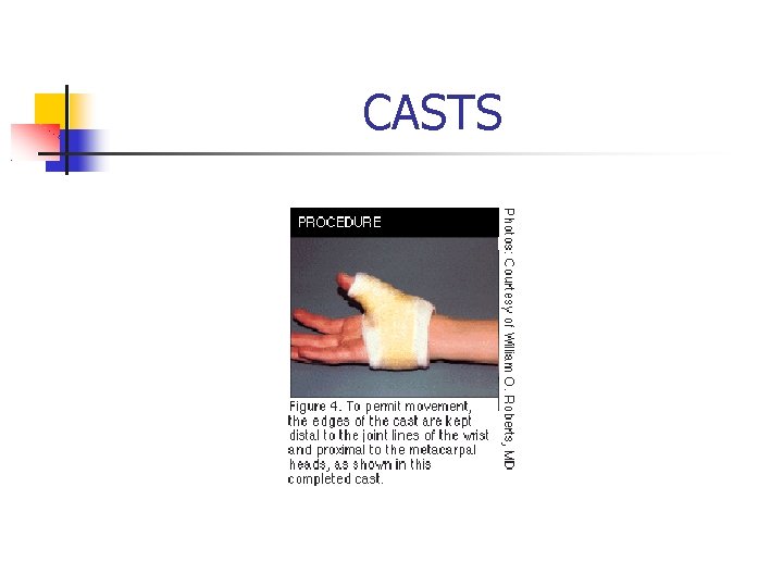 CASTS 