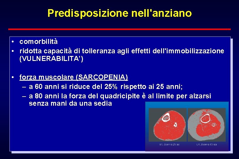 Predisposizione nell'anziano • comorbilità • ridotta capacità di tolleranza agli effetti dell'immobilizzazione (VULNERABILITA’) •