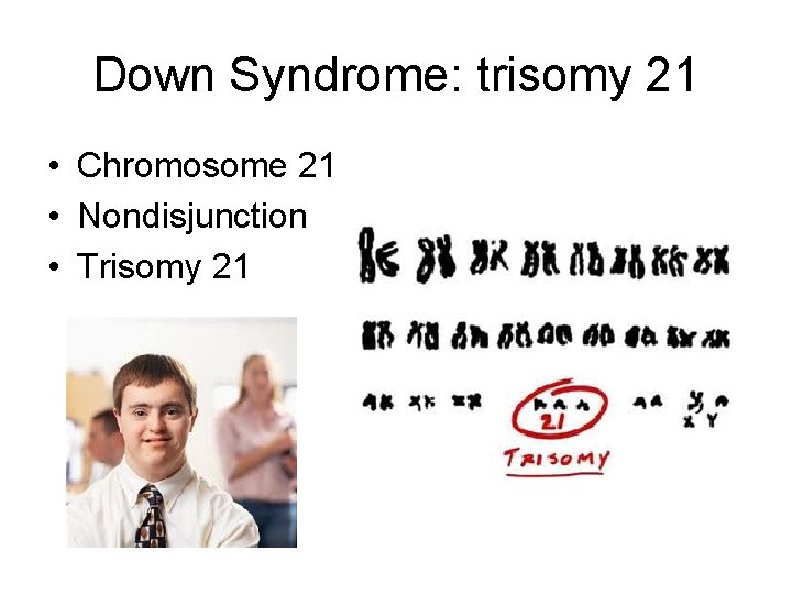 Down Syndrome: trisomy 21 • Chromosome 21 • Nondisjunction • Trisomy 21 