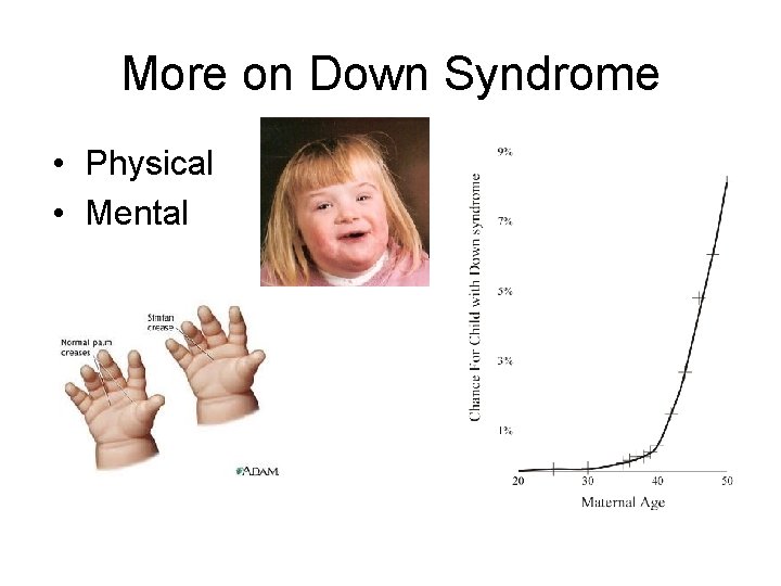 More on Down Syndrome • Physical • Mental 