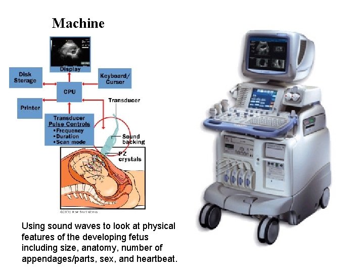 Machine Using sound waves to look at physical features of the developing fetus including